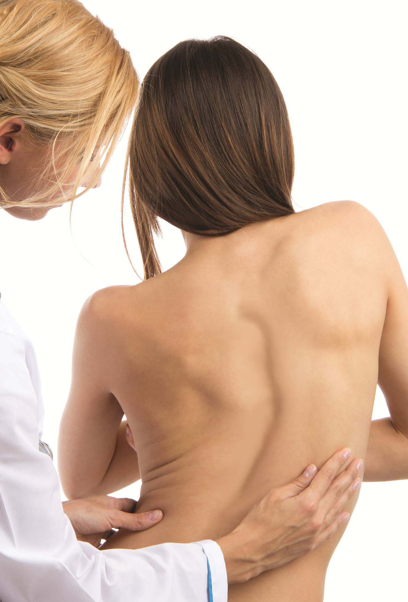 adolescent scoliosis